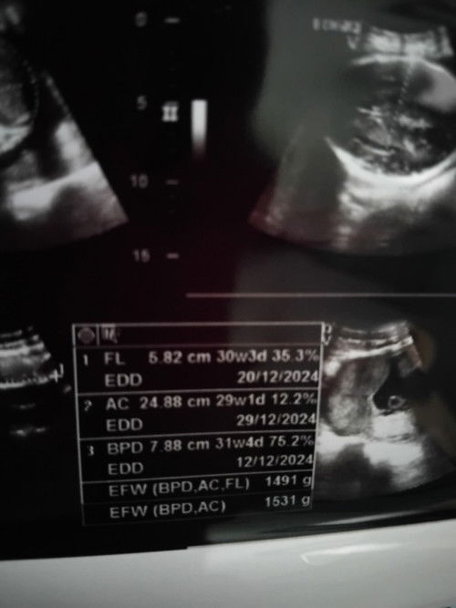 Bun maaf mau tanya kemarin aku usg tapi ko gak ada hasil ukuran panjang janin yah ?