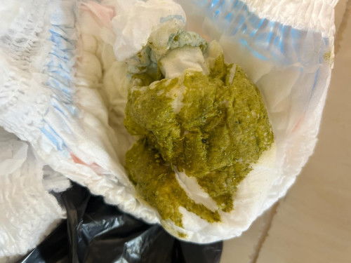 น้อง 8 เดือน กินนมแม่+อาหาร 1มื้อ อึสีเหลืองปกติ วันนี้พึ่งเริ่มกินนมผง อึออกสีเขียวๆ ปกติไหมค่ะ