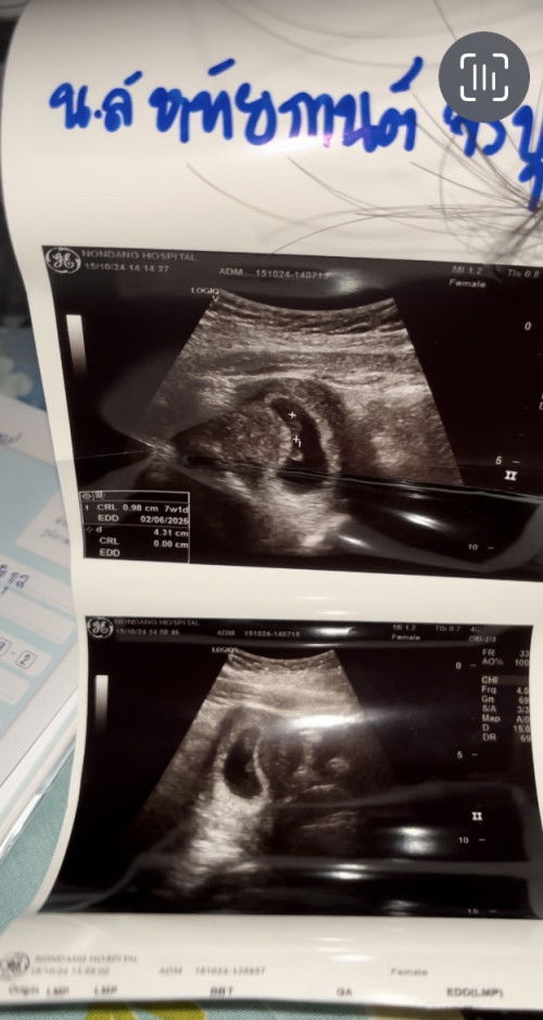 เป็นคุณแม่ครั้งแรก:)