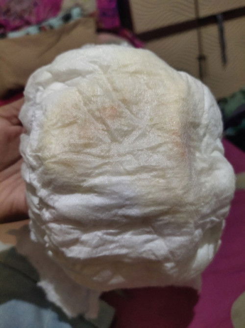 Bercak merah di diapers baby 6 bulan