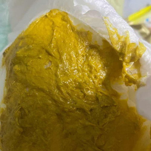 อึแบบนี้ปกติมั้ยคะ