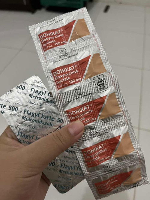 Keputihan berlebihan