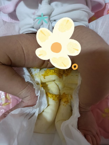 Hi mommy's, ask ko lang po: