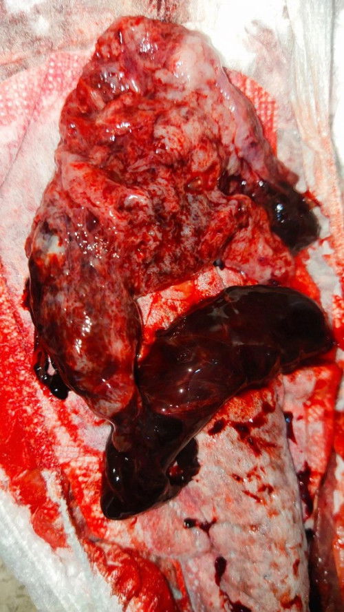 Telat haid n menstruasi keluar gumpalan