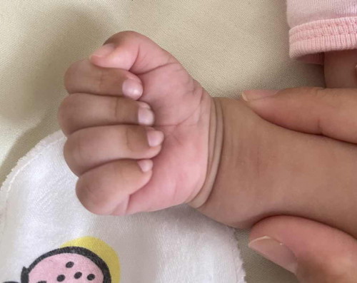 Hujung jari baby hitam