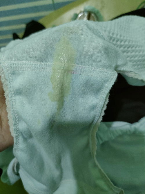 Seputar Keputihan Usia 22Week