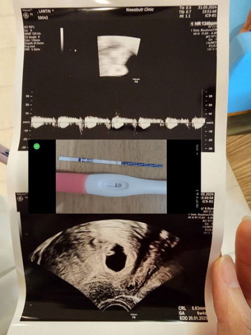 ฝากครรภ์เมื่อไหร่ดี ที่ไหนดี เอาสามีไปด้วยไหม มาลองอ่านกันค่ะ