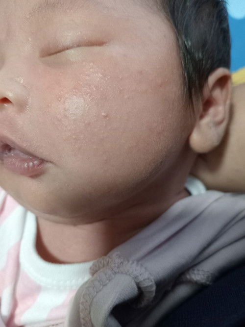 Assamualaikum.siapa ada bayi ada itu?
Boleh recommend cream. sye dah tanya dr.cakap normal shja.