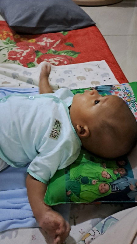 Bayi sering lihat ke atas