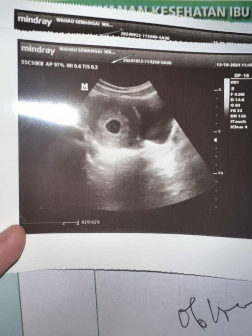 Flek dari uk 6-9 minggu