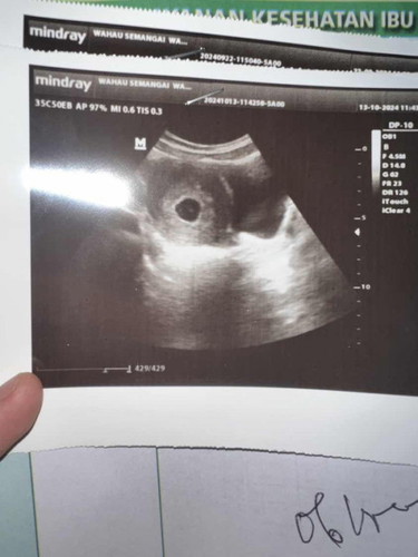 Flek dari uk 6-9 minggu