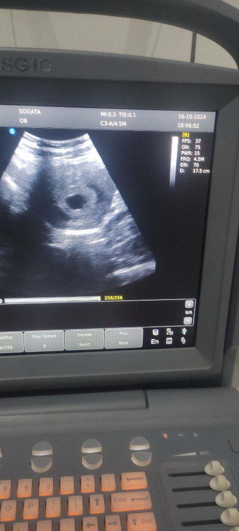 muncul flek dan darah