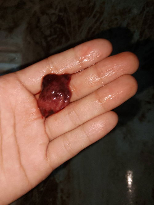 sharing tentang kehamilan