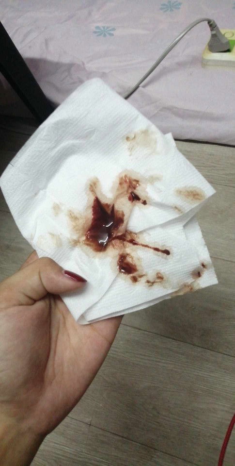 อันตราย​ไหมใครเคยเป็นบ้างค่ะ