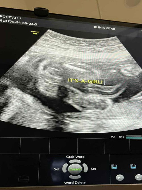 Tolong sy tengok ini boy or girl ye?