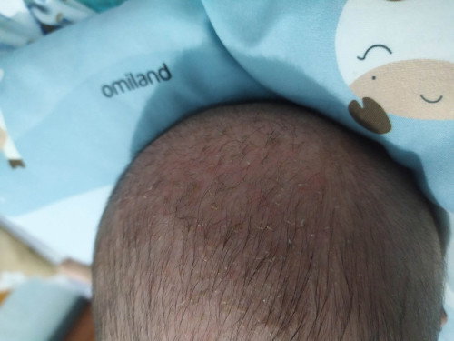 Sabun mandi bayi kuoit sensitif