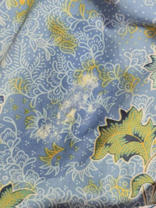 แบบนี้ต้องไปหาหมอมั้ยคะ