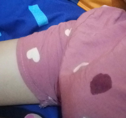 Bund dsni ad yg sama ga??