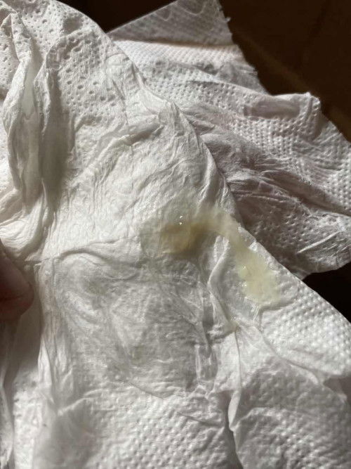 สอบถามเเม่ๆหน่อยค่ะ