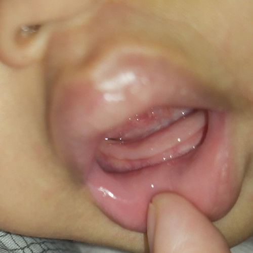 Tanda2 mau tumbuh gigi