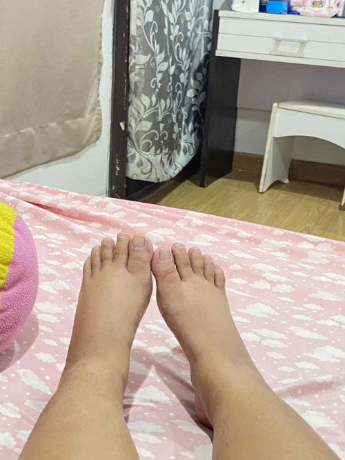 เท้าบวม1ข้าง