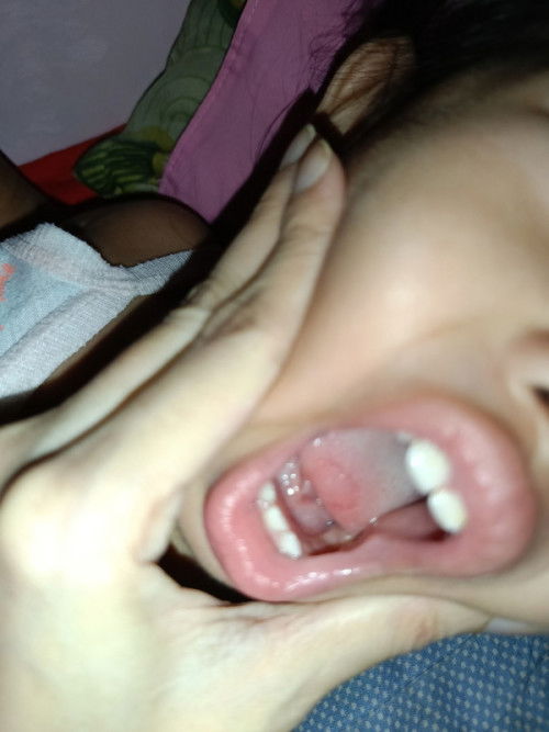 Ano po kaya ito mga mii? 1month napo yan pansin ko parang lumalaki pero wala naman nararamdaman baby