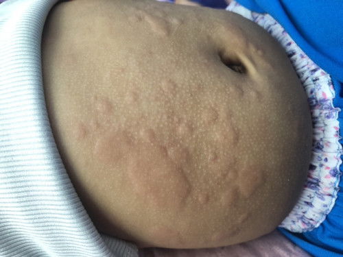 สอบถามแม่ๆหน่อยค่ะ