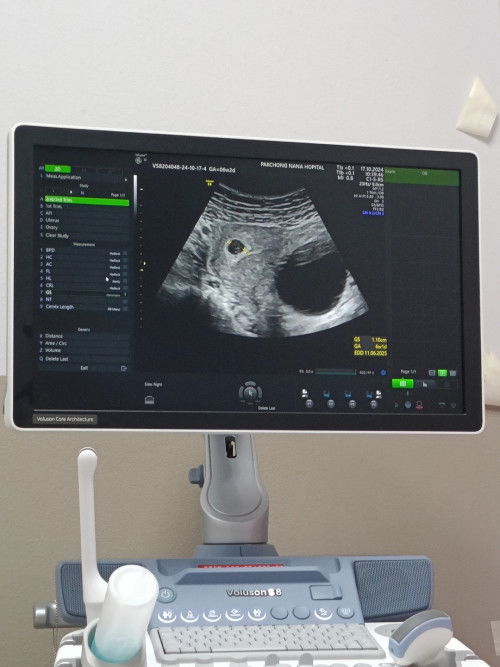 ไม่เจอตัวอ่อน เจอแต่ถุงตั้งครรภ์