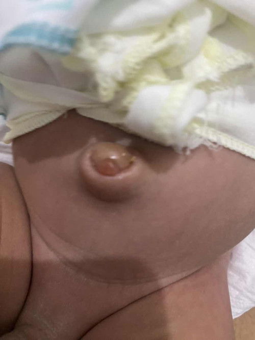 Pusar anak belom kering