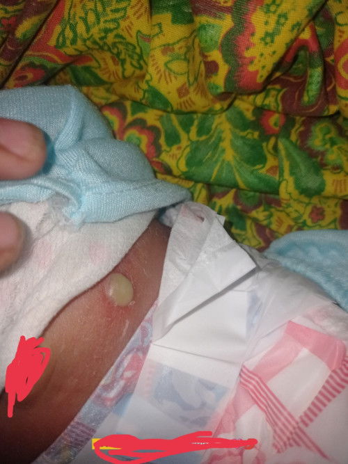 Mie sinomg nkaranas Dito ng ganito tulad ng baby ko anong pwedeng Gawin para mwla ito salamat mga mi