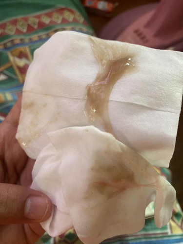 สอยถามหน่อยค่ะปกติไหม