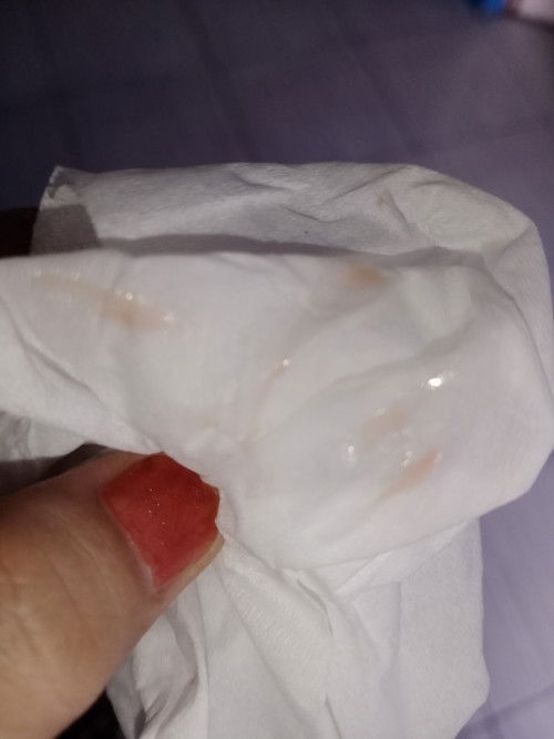 Bund baru aja keluar flek merah gini itu tanda2 mau lahir bukan bund?