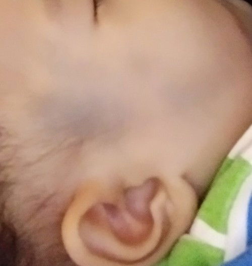 Tanda lahir atau bukan