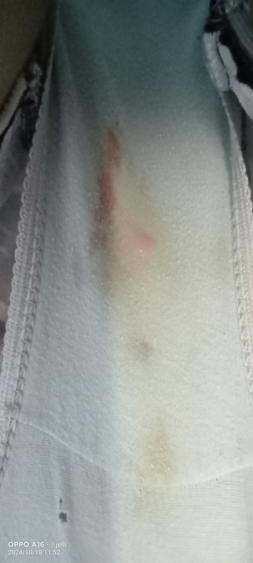 Spotting or konti dugo