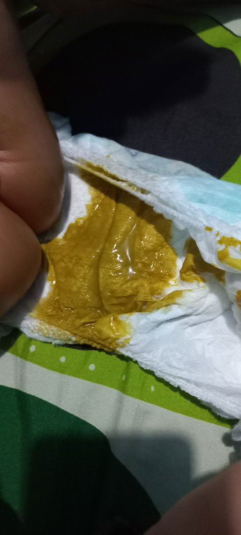 Bun ini diare bukan ya