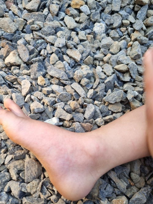 Bintik merah di kaki tangan muka