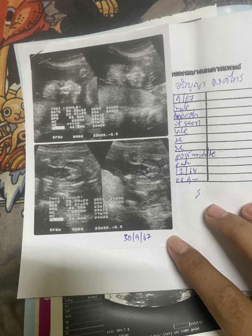 แม่ๆว่าได้ผู้หญิงผู้ชายค่ะ