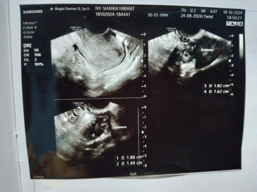 Flek coklat di usia 7 minggu