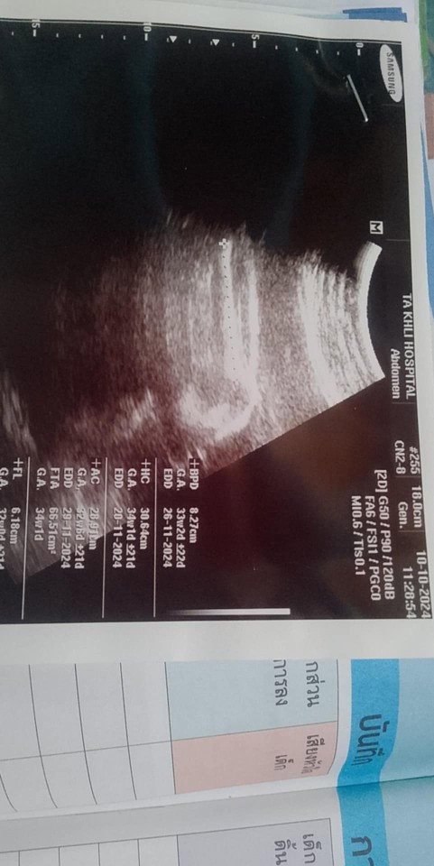 แม่ฟคนใหนพอจะทราบบ้างค่ะ