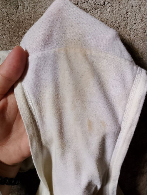 Normal pa ba Ang ganitonh discharge mga mi