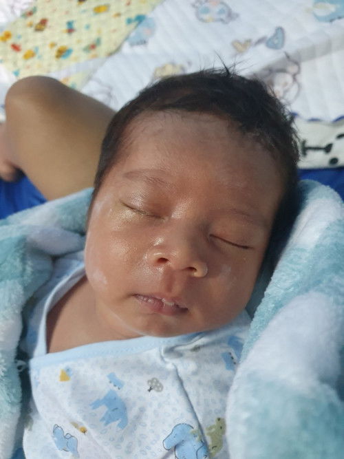 ลูกตาแฉะเช็ดทุกวันไม่ดีขึ้น