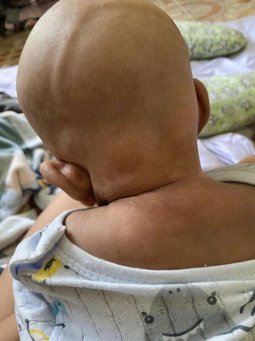 รอยด่างแบบนี้ใช่ครีมอะไรถึงจะหายค่ะ