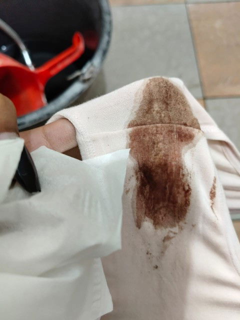 Flek coklat usia kandungan 10w 1hari