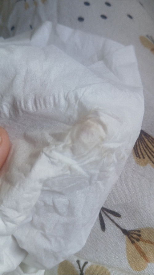 Ini keputihan atau flek ya bund