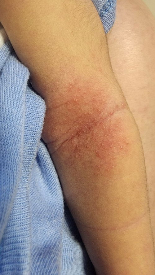 Any recommendations for rushes po?