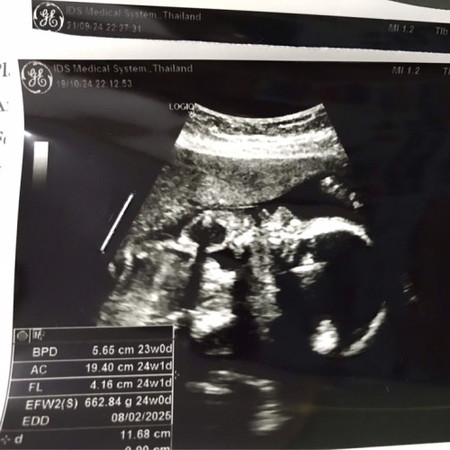 ลูกสาวจมูกได้พ่อมาก