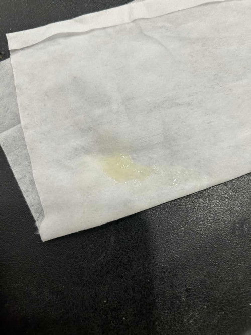 มีมูกใสๆข้นๆเหนียวๆใกล้คลอดแล้วใช่ไหมคะมูกปนเลือดยังไม่ออก