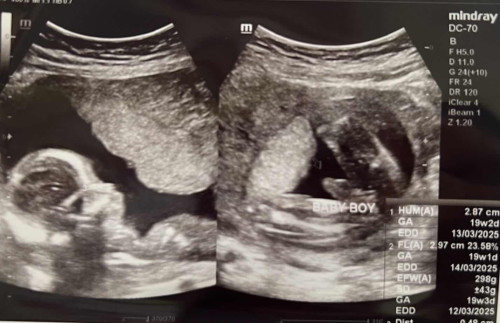 Scan gender