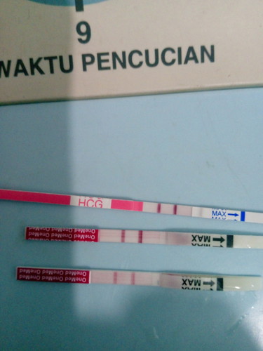 Wajar ngga si Bun hamil tapi ngga ngerasa apa" udh jalan 8weeks tapi kadang perut suka kaya kembung