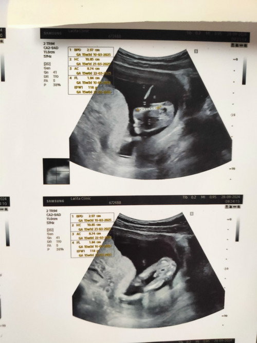 รู้เรื่องเพศลูก